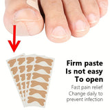 6PCS/sheet Ingrown Toenail Correction Sticker Adhesive Toenail Patch Elastic Nail Treatment Corrector Sticker Foot Care Tools